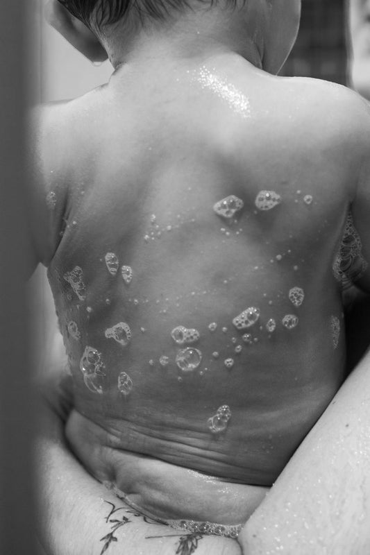 Trois Conseils pour prévenir les irritations de la peau